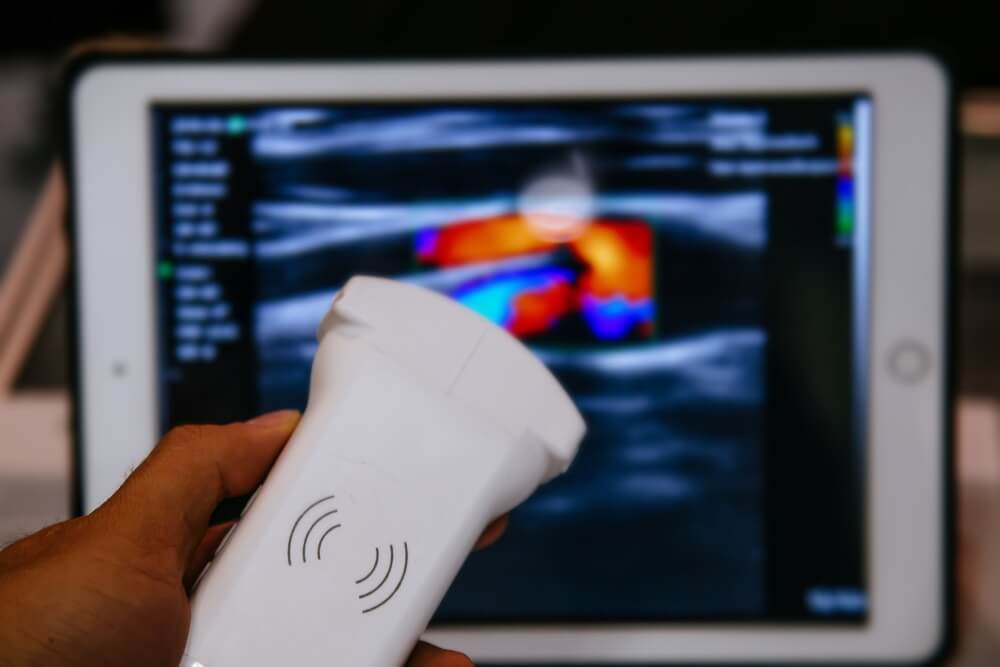 Future of Ultrasound Medical Devices explained by PostDICOM